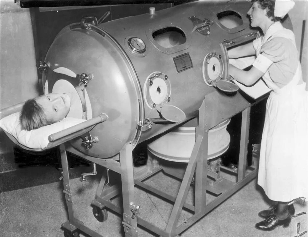 Железное легкое аппарат полиомиелит. Iron lung медицинский аппарат. Батискаф Iron lung.