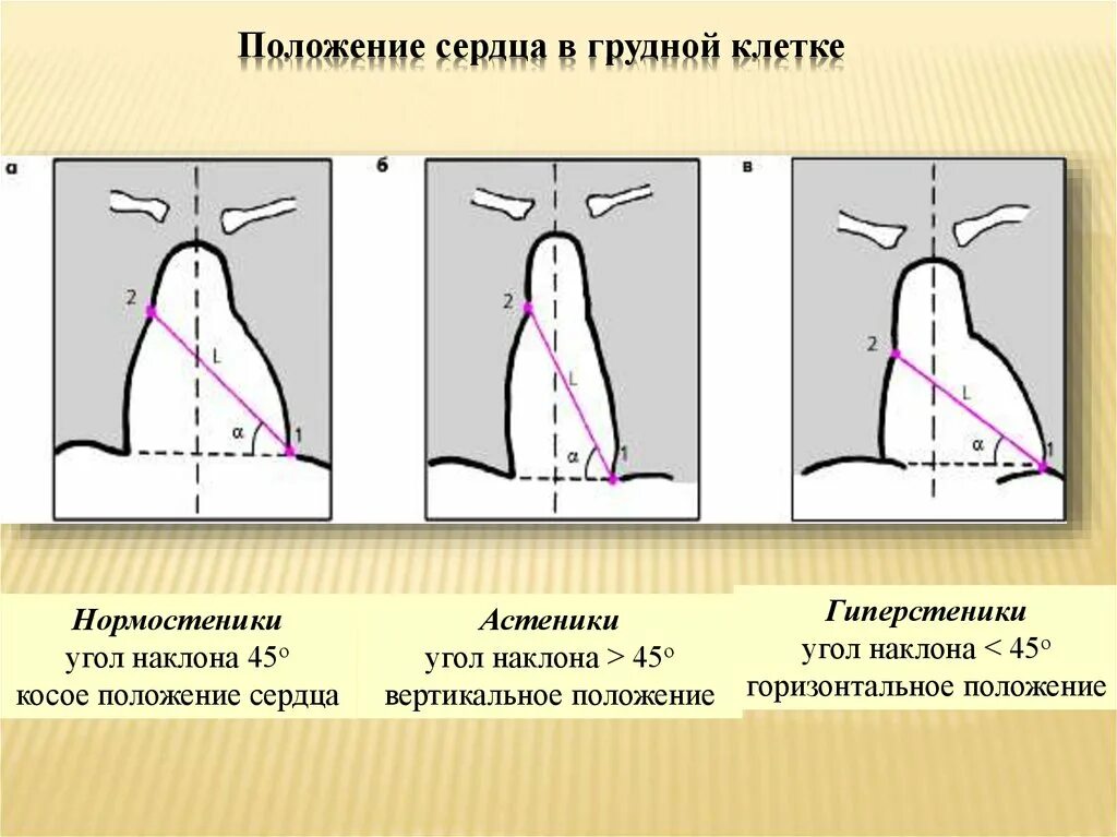 Вертикальная позиция сердца. Типы положения сердца. Положение сердца в зависимости от типа телосложения. Положение сердца в грудной клетке.