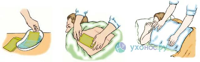 Техника наложения компресса. Техника наложения горчичников. Постановка горчичников на грудную клетку детям. Горчичник на грудину.