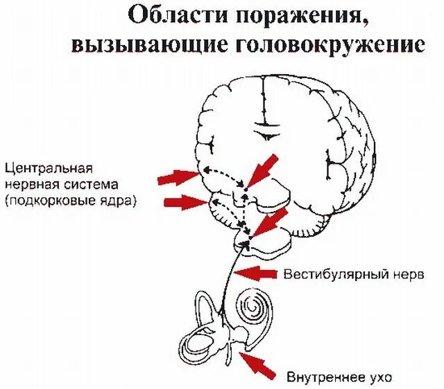 Головокружение 4 день