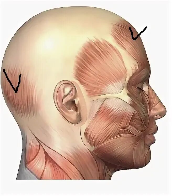 Складка на затылке у мужчин. Расслабление затылка. Гипертонус лобной мышцы.