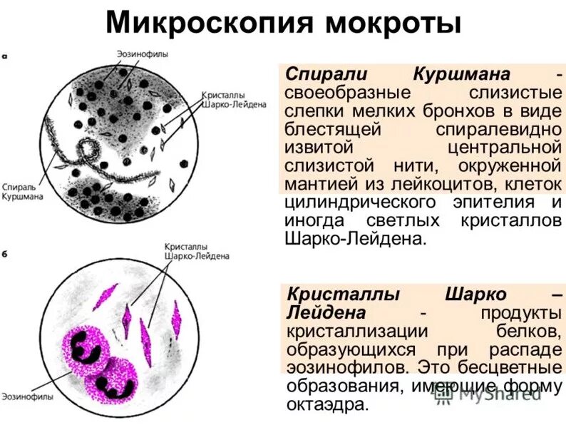 Мокрота астматика
