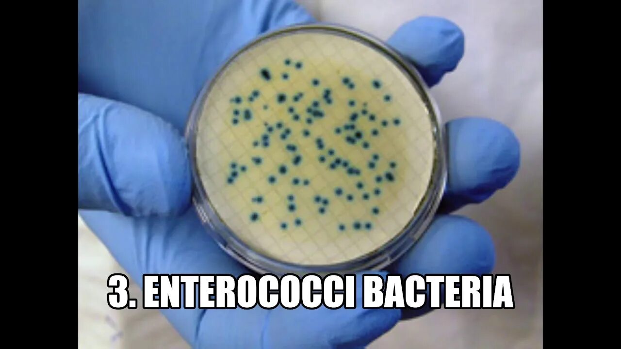 Энтерококк фэциум. Энтерококки кишечная палочка. Энтерококки микробиология. Enterococcus faecium микробиология. Кал на поверхности воды