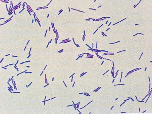 Бифидобактерии в кале. Лактобациллы окраска по Граму. Лактобактерии микроскопия. Палочки Дедерлейна. Лактобациллы палочки Дедерлейна.