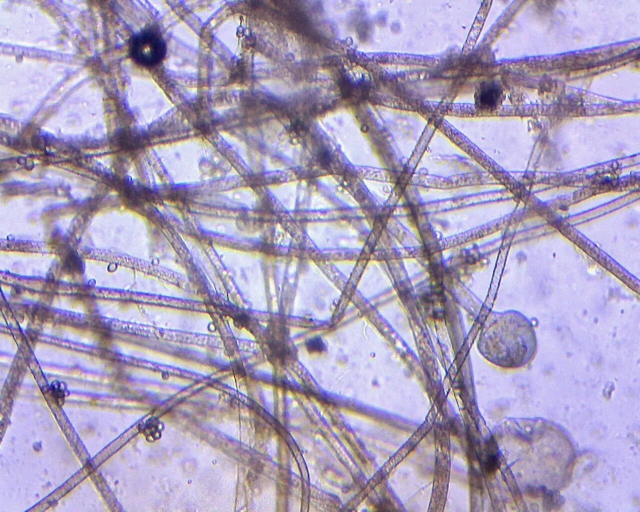 Споры гриба и нити. Мукор под микроскопом. Мукор ризопус. Мицелий мукора под микроскопом. Плесень мукор в микроскопе.
