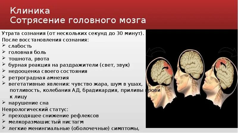 Было ли сотрясение. Сотрясение мозга симптомы. Проявления сотрясения головного мозга. Признаки сотрясения головы. Сотрясение головы и головного мозга.