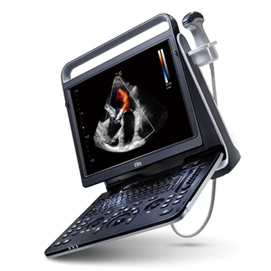 Chison sonotouch 60. Sonotouch 30. Chison st 30. Chison sonotouch 60. Sonotouch 30.