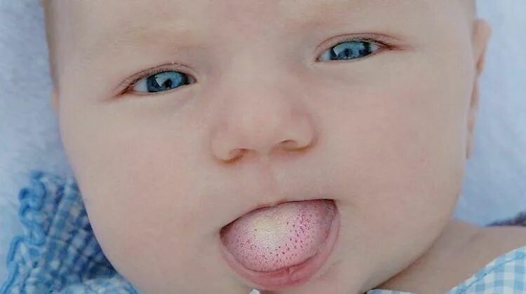 Молочница у мужчин фото - Фотобанк Fotodao.ru
