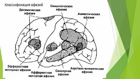 Динамическая зона