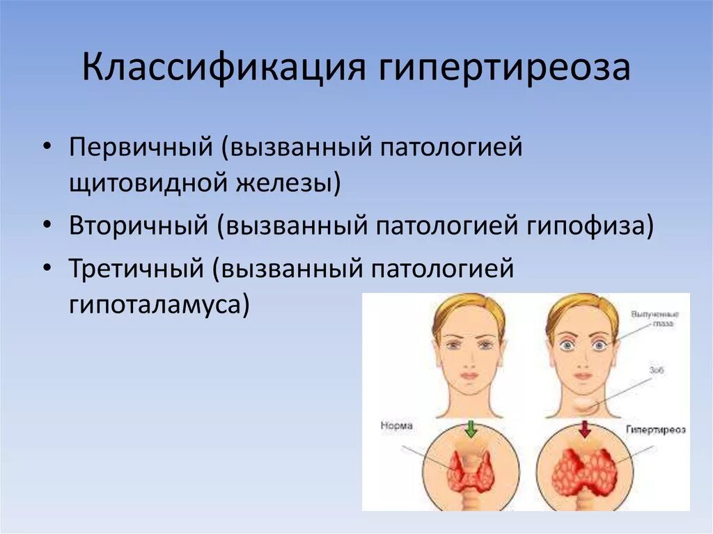 Повышена функция щитовидной. Первичный гипертиреоз причины патогенез. Гиперфункция щитовидной железы (первичная форма). Гипертиреоз щитовидной железы. Причины заболевания гипертиреозом.