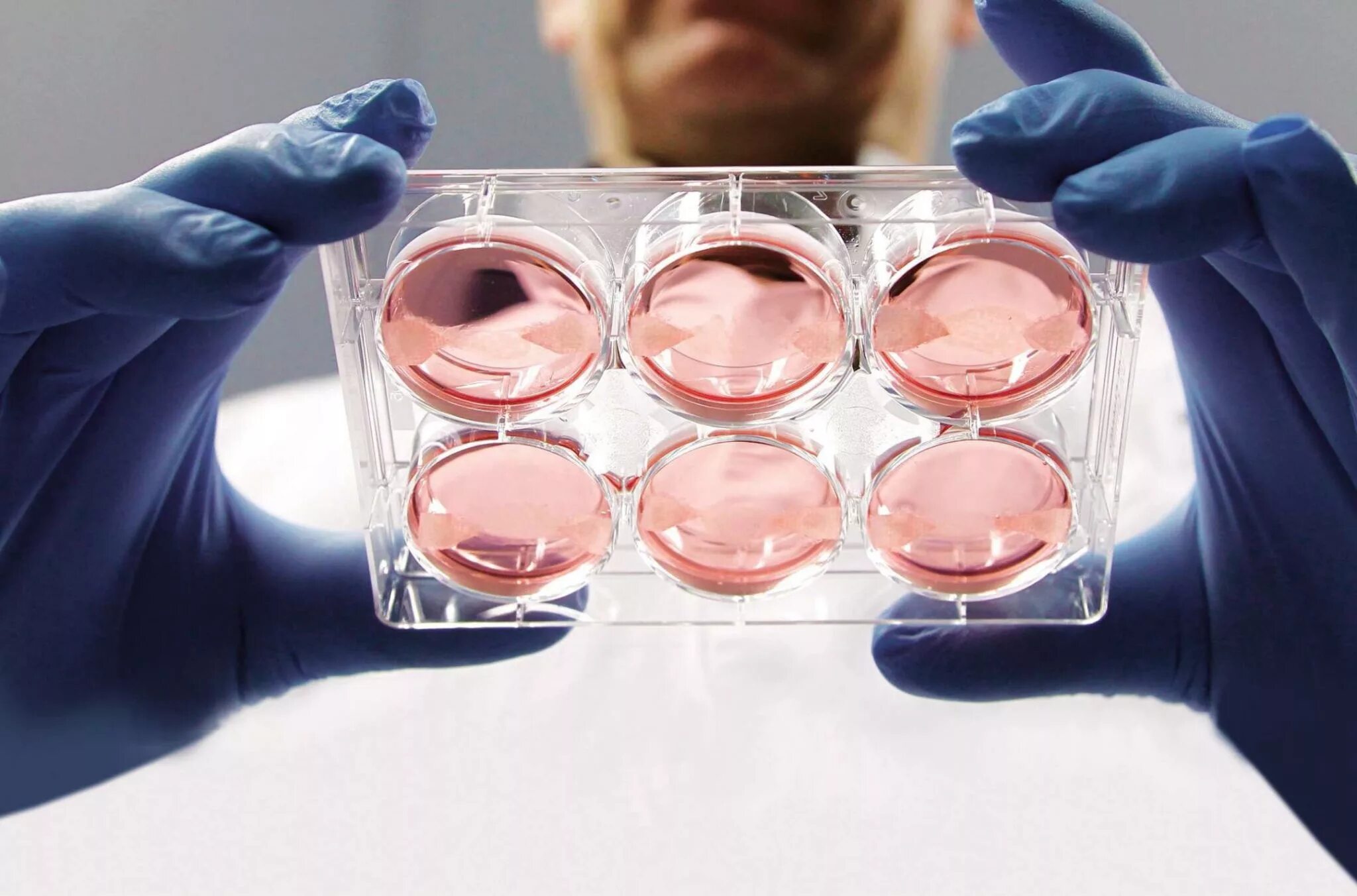 Сроки имплантации эмбриона после овуляции. Яйцеклетка в чашке петри. Клонирование органов и тканей. Среда для эмбрионов. Биохимические реакции эмбриона.