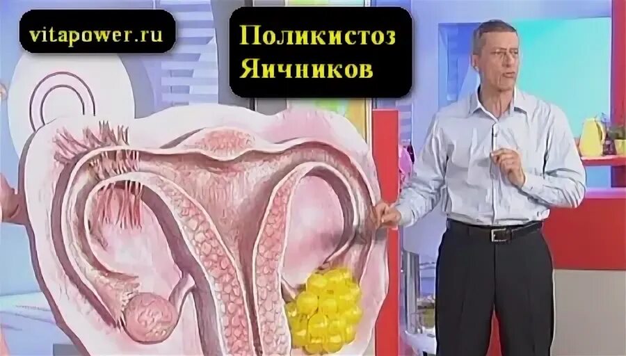 Группа яичников