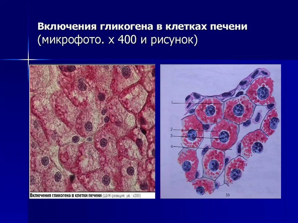 Железистые клетки печени. Включения гликогена в печени гистология. Включения гликогена в печени аксолотля. Углеводные включения гистология. Включения гликогена препарат гистология.