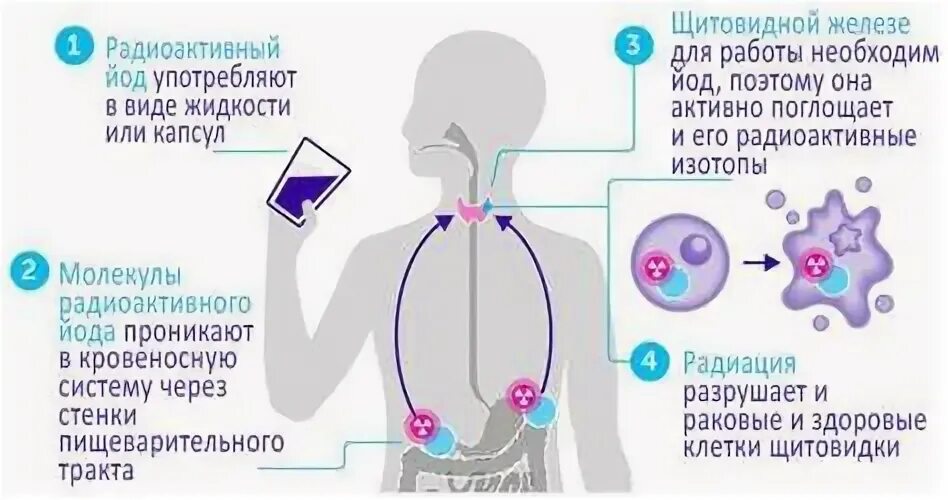 После приема радиоактивного йода
