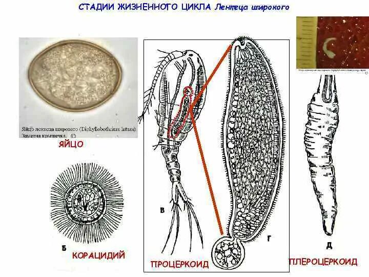 Личинки лентеца. Процеркоид и плероцеркоид. Финна широкого лентеца строение. Процеркоид широкого лентеца. Корацидий процеркоид плероцеркоид.