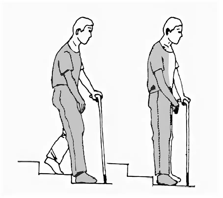 Трость для ходьбы после перелома. Палка для ходьбы пожилым людям. Передвижение с тростью. Костыли для пожилых для ступеней.