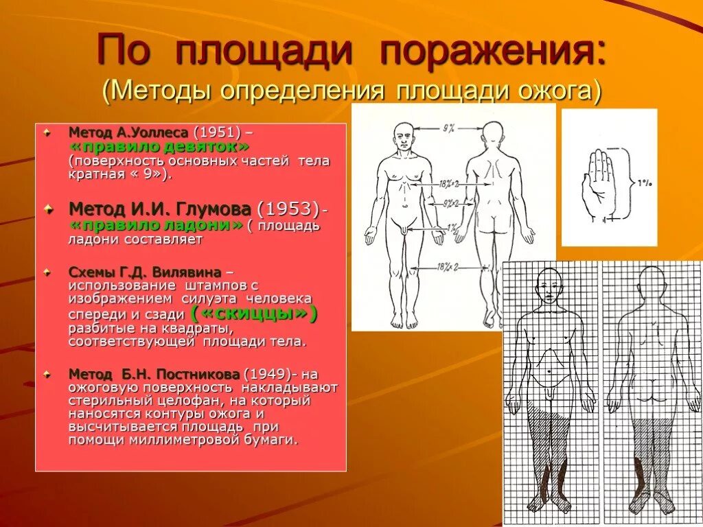 Площадь поражения при ожогах. Методы оценки площади ожога. Схема определения площади ожогов по Вилявину. Схемы Вилявина для определения площади ожога. Метод определения площади ожога и степени.