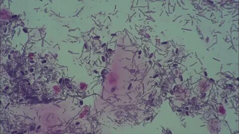 Candida vaginalis