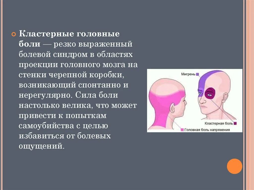 Коитальная цефалгия. Кластерные головные бо. Кластерная головная боль синдромы. Кластернарная головная бошь. Пучковая кластерная головная боль.