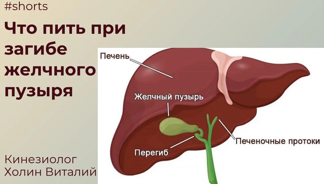 Перегиб желчного пузыря. Загиб желчного пузыря. Прогиб желчного пузыря. Изгиб желчного симптомы