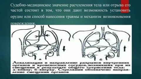 Расчленение это