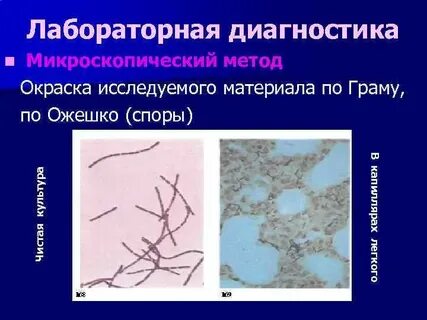 Метод окраски спор бактерий