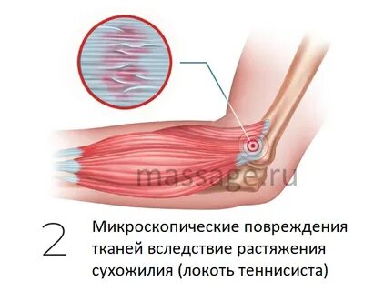 Случайные повреждения это