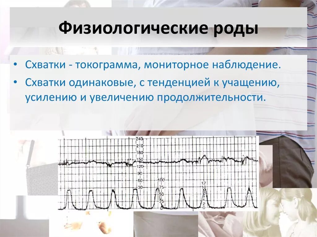 Критерии физиологических родов. Физиологические роды презентация. Физиологические и патологические роды. Токограмма физиологических родов.