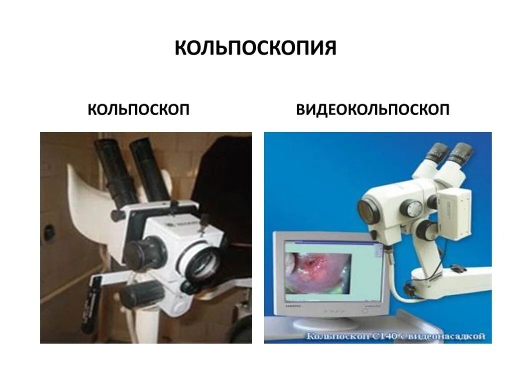 Люминесцентная кольпоскопия. Расширенная кольпоскопия. Кольпоскопия аппарат. Для чего назначают кольпоскопия в гинекологии