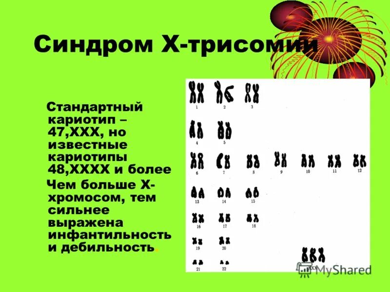 Трипло х. Синдром трисомии кариотип. Синдром трисомия кариотип. Синдром трисомия х кариотип. Кариотип больного с синдромом трисомии - х:.