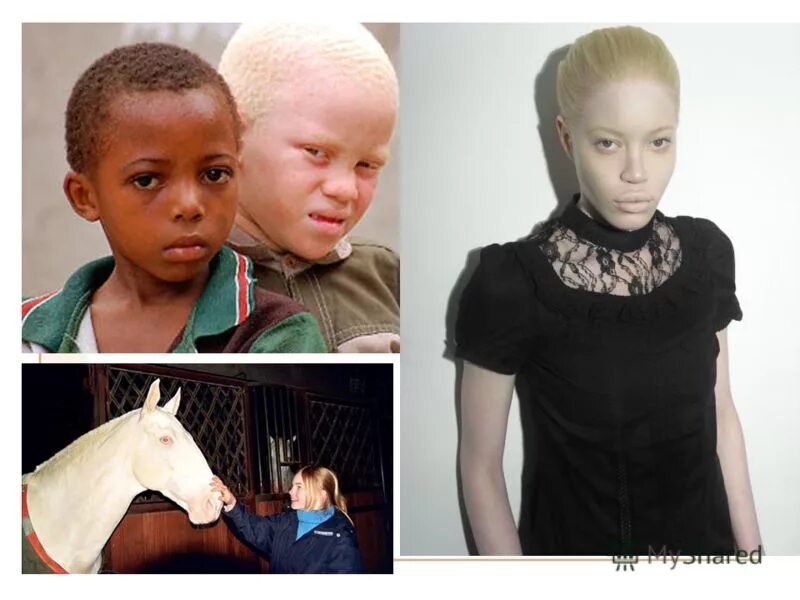 Альбинизм наследственное заболевание