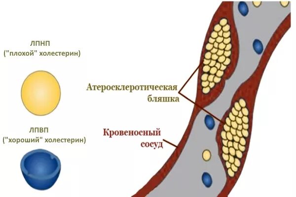 Плохой холестерин. Хороший холестерин. Плохой и хороший холестерин картинка. Хорошие и плохие липопротеиды.