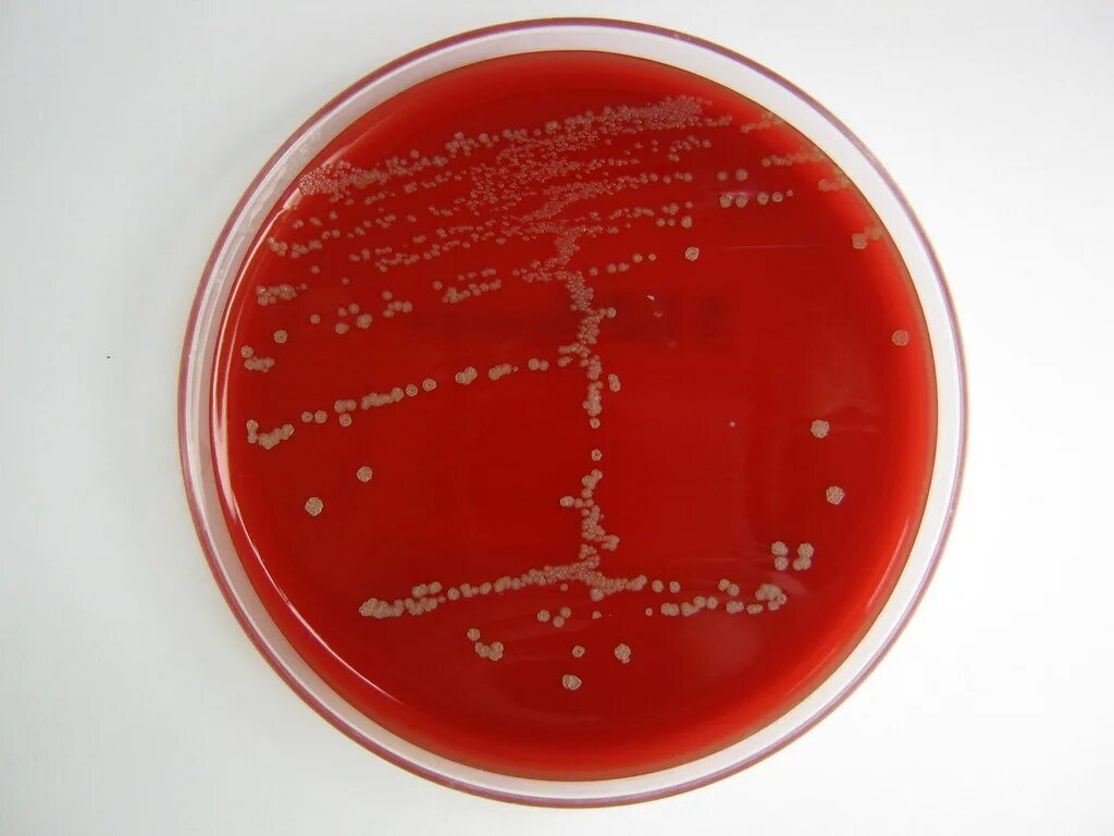 Fusobacterium spp