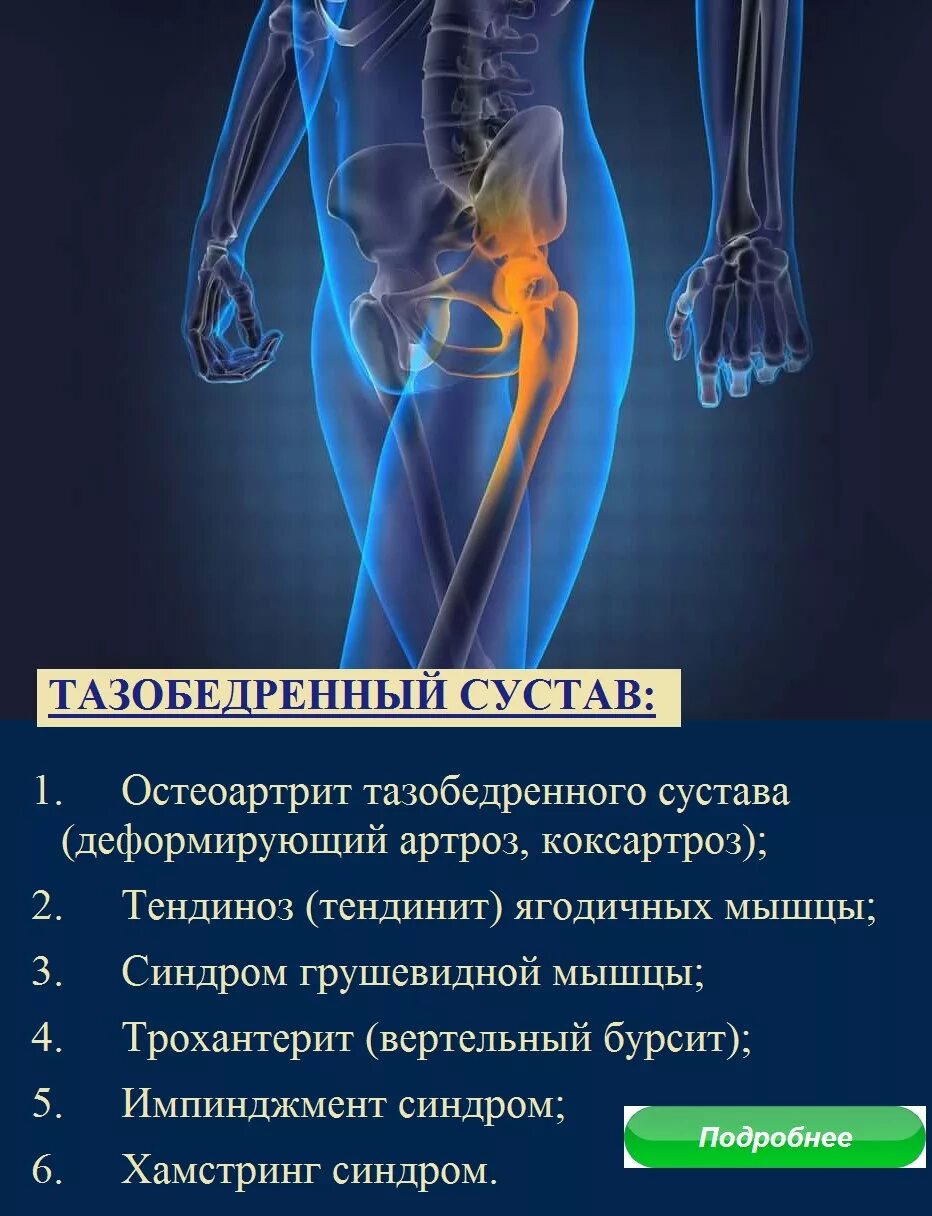 Тазобедренная боль у женщин причины и лечение. Тазобедренный сустав. Боль в тазобедренном суставе. Боль в бедренном суставе. Бедренный сустав болит.