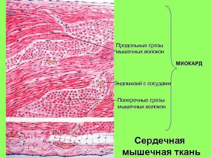 Поперечный и продольный срез. Гладкая мышечная ткань срез матки. Гладкая мышечная ткань гистология продольный срез. Гладкая мышечная ткань эндомизий. Продольный и поперечный срез гладкой мышечной ткани.