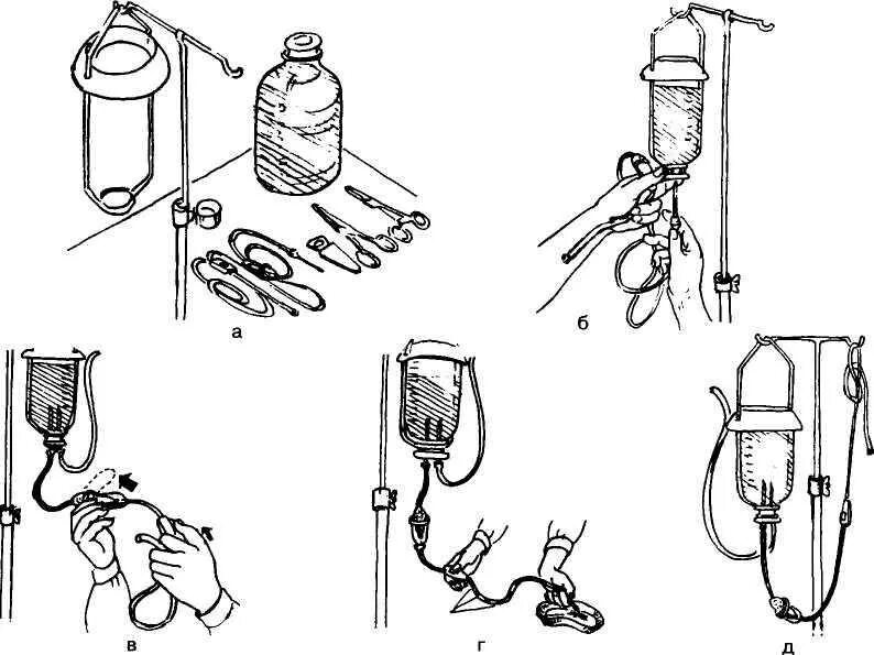 Заполнение внутривенной системы алгоритм. Заполнение системы для внутривенного капельного вливания. Техника постановки капельницы внутривенно. Капельная система для внутривенного введения алгоритм. Внутривенное капельное вливание алгоритм.