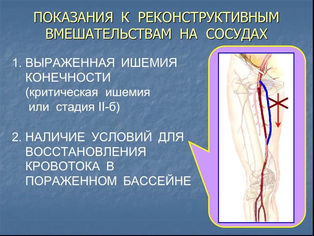 Операция на сосудах нижних конечностей