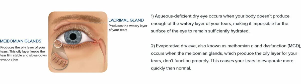 Tear me перевод. Болезнь глаз от сквозняка. Eye topography Dry Eye.