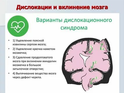 Дисфункции срединных структур у детей