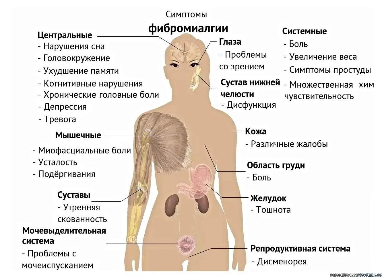 Может ли человек болеть. Фибромиалгия. Симптомы фибромиалгии. Фибромиалгии у взрослых симптомы. Фибро алгия.