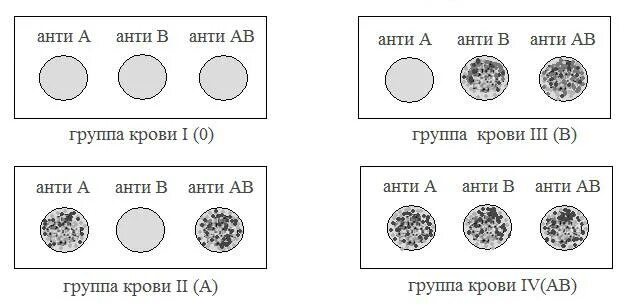 Цоликлоны для определения группы крови и резус фактора. Определение группы крови и резус фактора цоликлонами таблица. Определение группы крови по цоликлонам алгоритм. Определение группы крови и резус фактора с помощью цоликлонов.