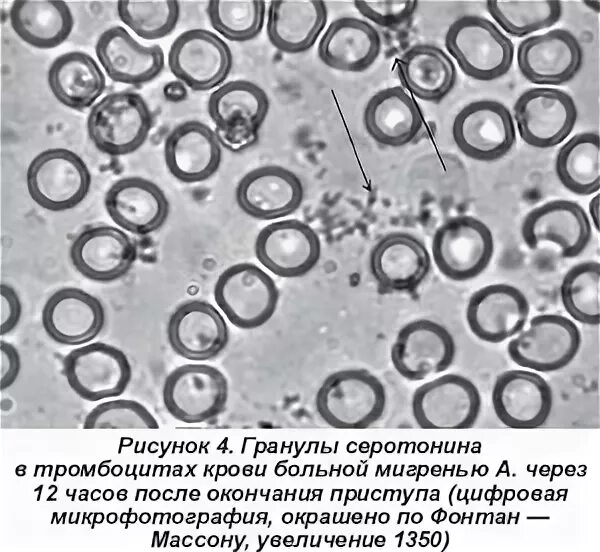 Гранулы тромбоцитов содержат