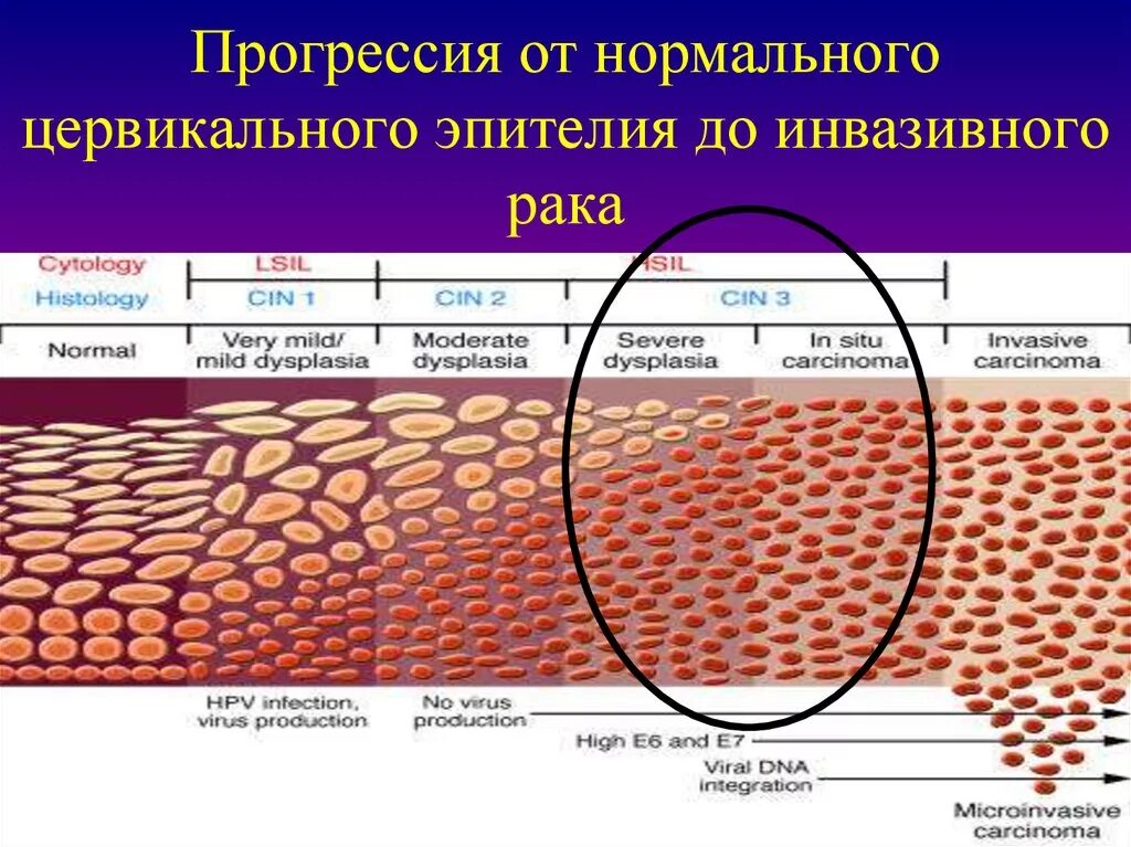 Компонент эндоцервикса и зоны. Эпителий цервикального канала. Слои плоского эпителия шейки матки. Толщина эпителия шейки матки. Цилиндрический эпителий цервикального канала.