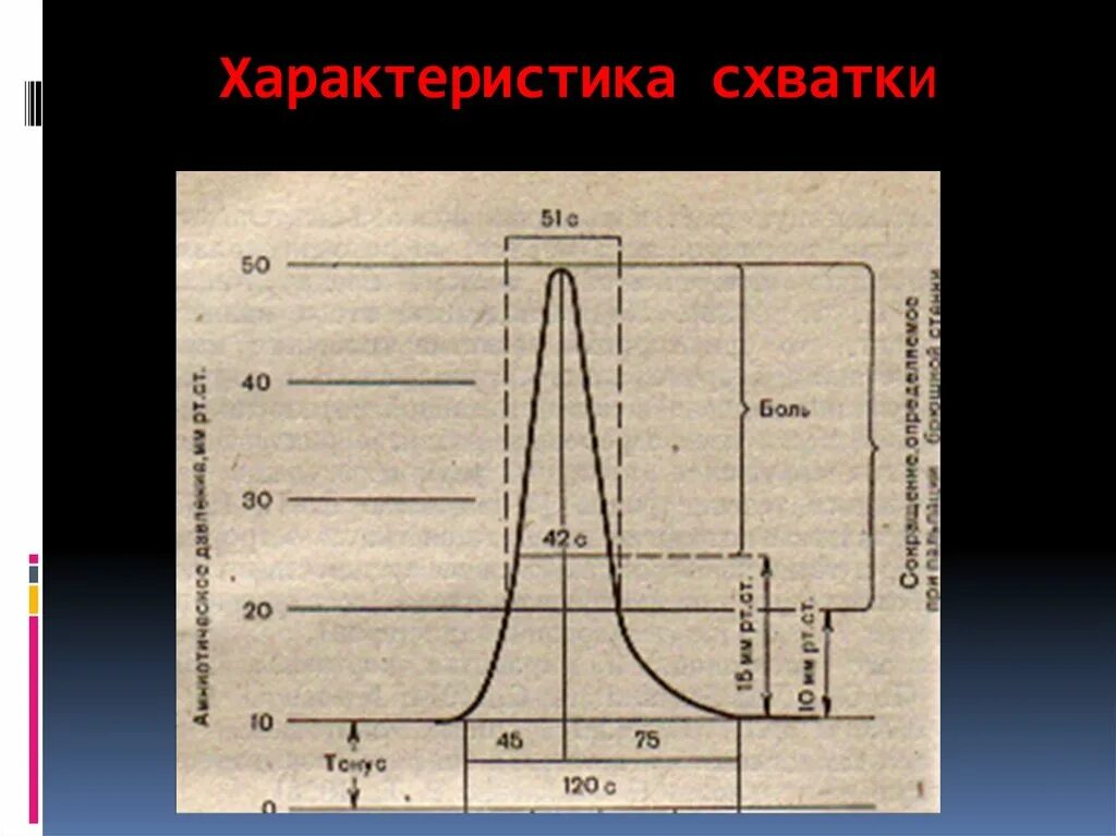 Оценка схваток