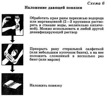 Когда следует накладывать давящие повязки ответ