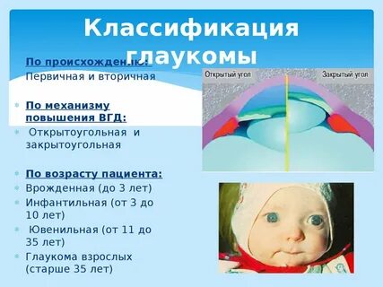 Первая стадия глаукомы