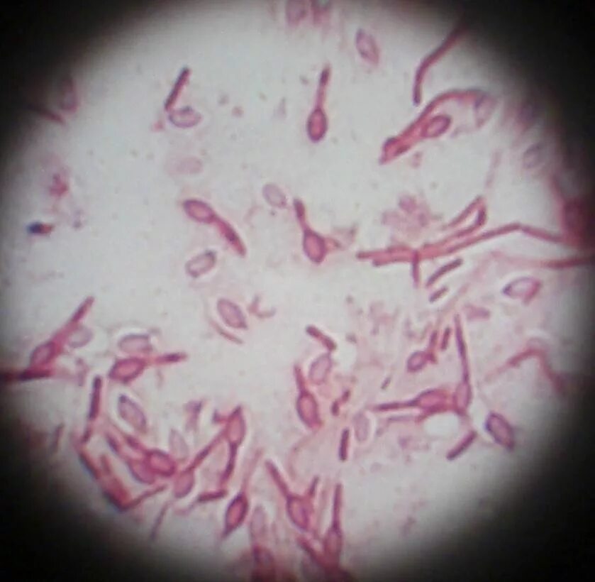 Бацилла цереус возбудитель. Сальмонелла Тифи микроскоп. Bacillus megaterium морфология. Haemophilus spp у мужчин
