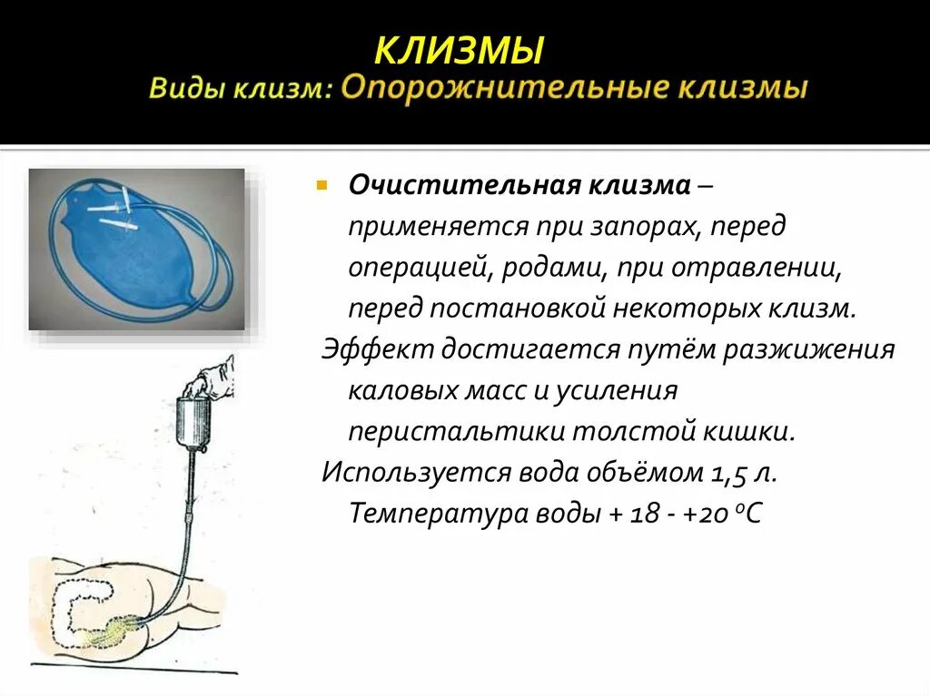 Сколько в туалете клизма. Разновидности клизм. Виды очистительных клизм. Виды опорожнительных клизм. Очистительная клизма перед операцией.