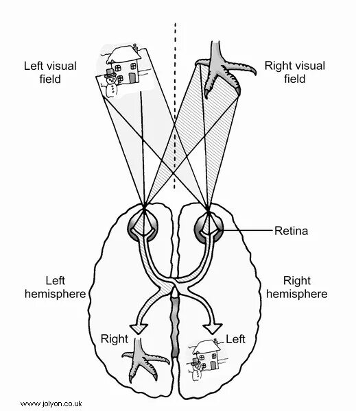 Split brain. Эксперимент Сперри. Исследования расщепленного мозга. Сперри расщепленный мозг. Эксперименты с расщепленным мозгом.