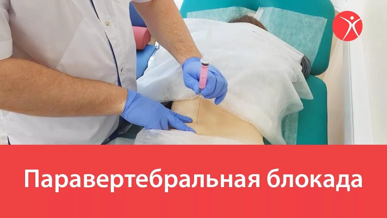 Паравертебральная поясничная блокада. Паравертебральная блокада поясничного отдела позвоночника. Паравертебральные блокады поясничного отдела позвоночника. Паравертебральная новокаиновая блокада показания. Техника паравертебральной блокады поясничного отдела.